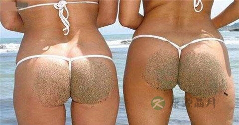 肛门息肉会不会自愈 肛门息肉会不会自愈