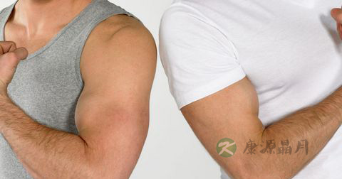 手臂肌肉酸痛怎么办