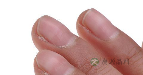 透过指甲可以看出这38种病