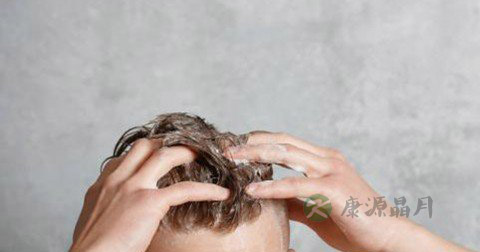 男人掉头发很厉害怎么办