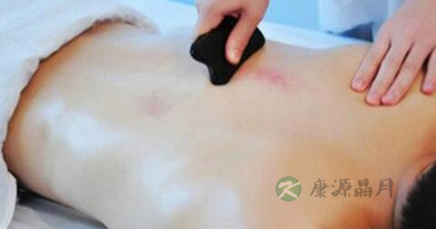 中医去除痤疮怎么样 中医去除痤疮怎么样