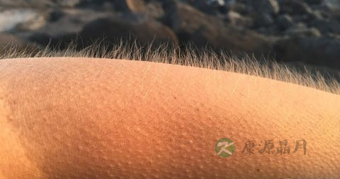 肘部皮肤粗糙怎么办 肘部皮肤粗糙怎么办