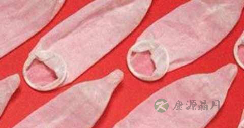 男人怎么避孕检查