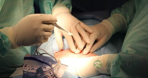 割包茎注意事项 割包茎注意事项