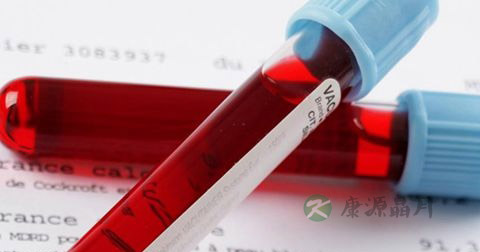 HIV阳性是什么意思 HIV阳性是什么意思