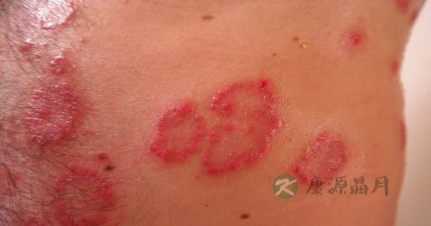 手上有小红点是什么东西
