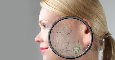 脸上痤疮怎么样治 脸上痤疮怎么样治