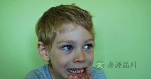 包皮危害有哪些