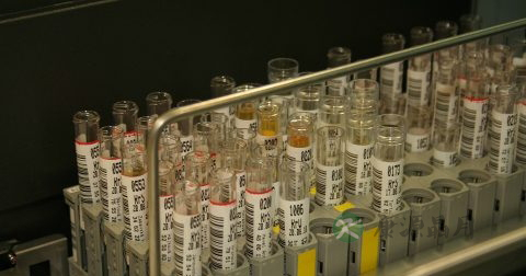 睾丸炎如何治疗