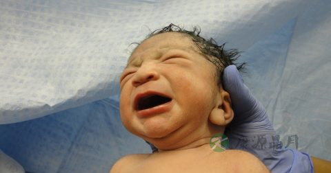 脑积水的原因 脑积水的原因