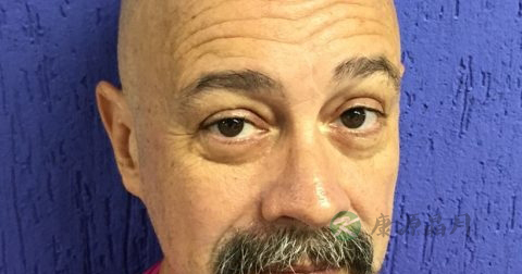 男生脱毛的方法