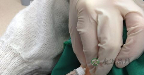 手淫不孕不育怎么治疗 手淫不孕不育怎么治疗