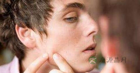 结节性痤疮治疗方法 结节性痤疮治疗方法