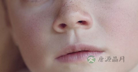 鼻屎多怎么回事