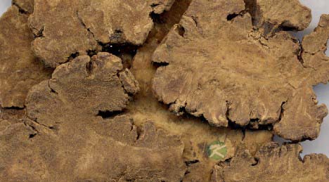 盘点月经迟到的六大原因