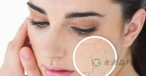 九大细节提示女人气血不足