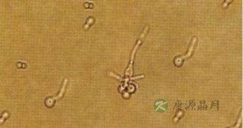阴道瘙痒不能吃什么