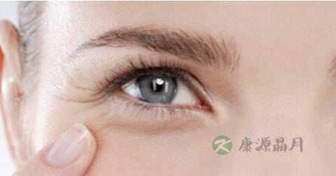 手术去除鱼尾纹