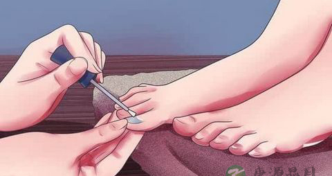 产妇可以剪指甲吗