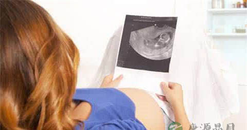 孕妇拍片子对胎儿有什么影响 孕妇拍片子对胎儿有什么影响