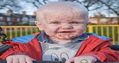 孕妇可以吃花椒粉吗