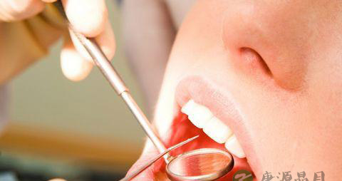 孕前口腔检查必要吗