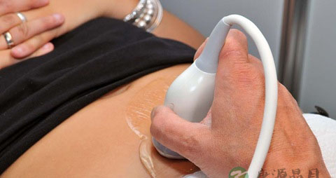 胎儿性别鉴定方法