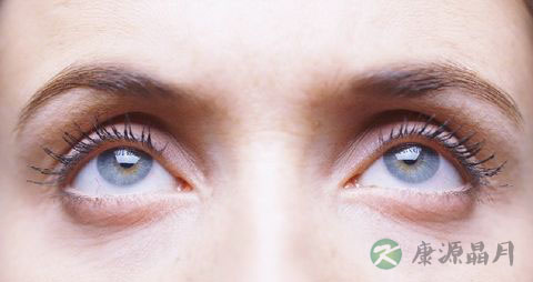 孕妇有眼袋怎么办？去除眼袋的方法