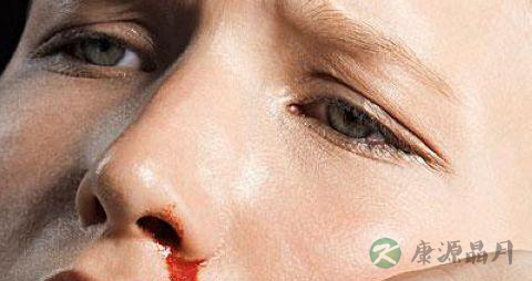 孕妇流鼻血的原因和处理办法