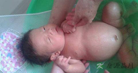 小婴儿正常肚子有多大