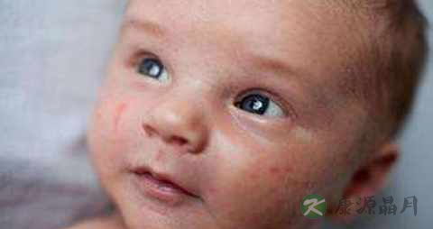 怎样照顾婴幼儿不生病