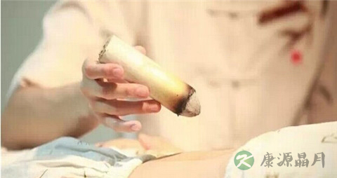 艾灸治疗小儿扁桃体炎怎么样