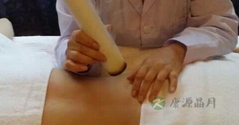 肚脐艾灸可以减肥吗