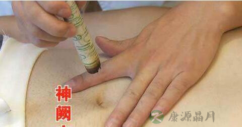 肚脐艾灸可以减肥吗