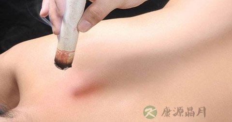 用艾灸可以减肥吗