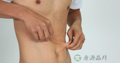 用热敷肚子可以减肥吗