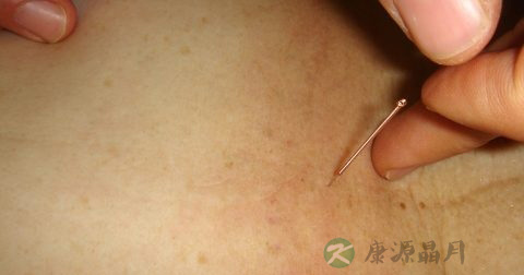 用艾灸多久可以减肥吗