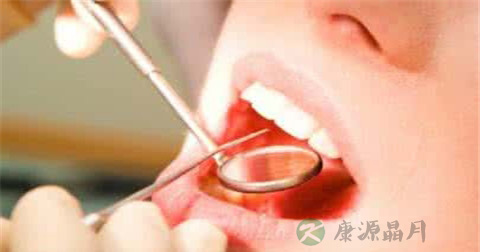 坏死性龈口炎的症状