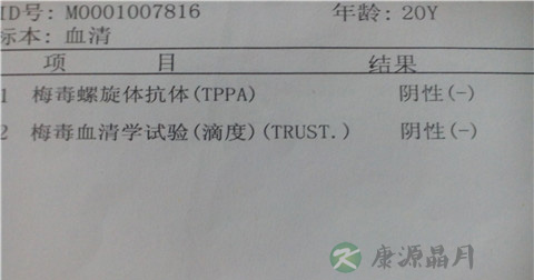 梅毒血清试验多少钱