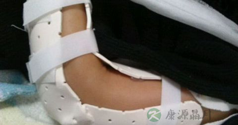 小孩骨折不疼怎么回事
