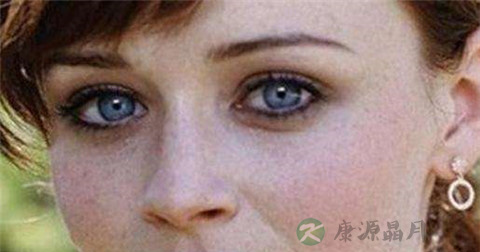 血友病的症状有哪些