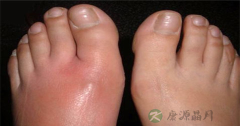 丹毒是看什么科的
