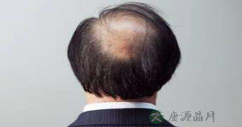 头上毛囊炎是怎么引起的