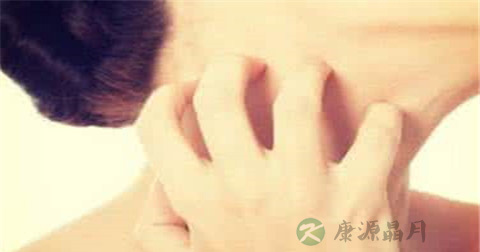 寒冷型荨麻疹是什么