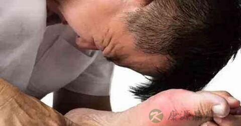 体检尿酸偏高的原因