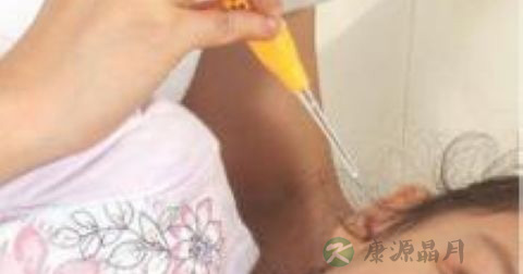 急性化脓性中耳炎并发症