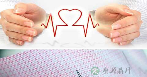 什么是窦性心律不齐