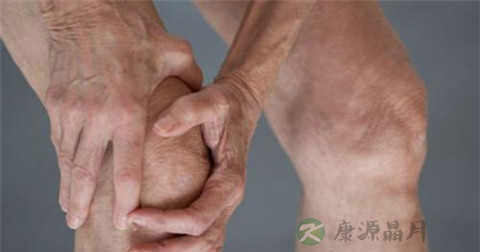 类风湿吃什么药最好