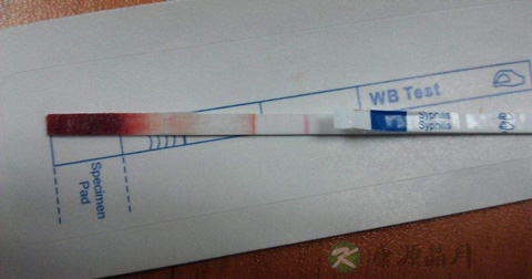 梅毒自测试纸怎么用