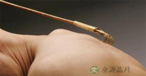 接触性皮炎是什么引起